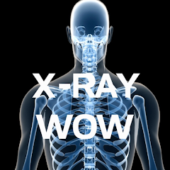 Las mejores aplicaciones de rayos X para descargar gratis