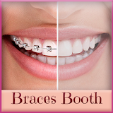 Teeth Braces Photo Editor App icon