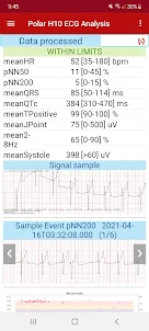 Polar H10 ECG analysis