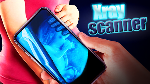 Real ROENTGEN filter