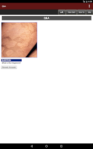 Imágen 23 Fitzpatrick's Dermatology Flas android