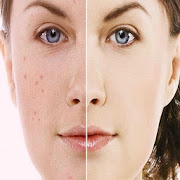 Top 23 Beauty Apps Like Pimples Removing Tips - Best Alternatives