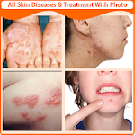 Cover Image of Скачать Все кожные заболевания и лечение  APK
