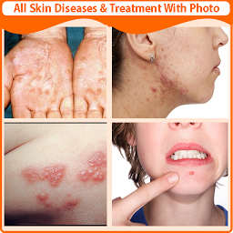Icon image Skin Diseases and Treatment