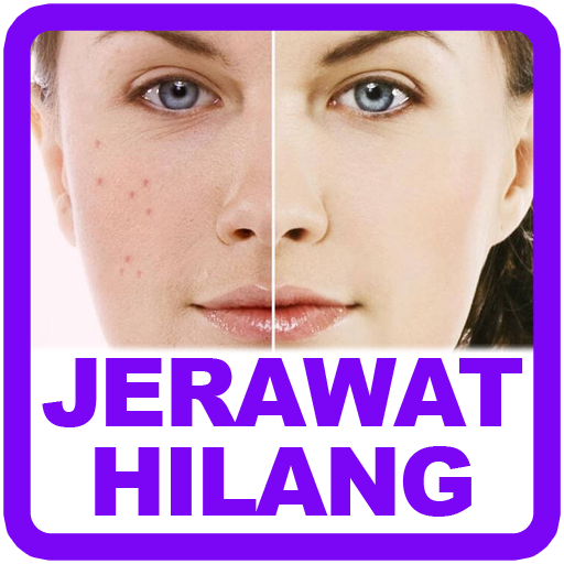 Cara Menghilangkan Jerawat