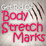 Get Rid of Body Stretch Marks Naturally icon