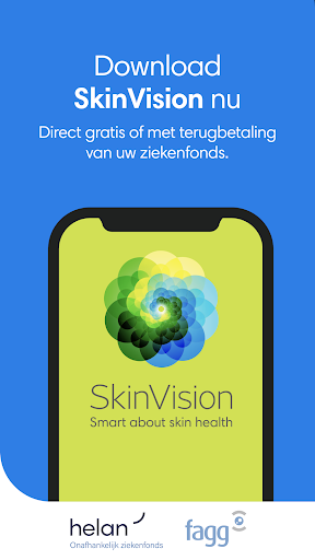 SkinVision - herken huidkanker