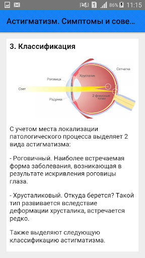 Астигматизм. Симптомы и советы