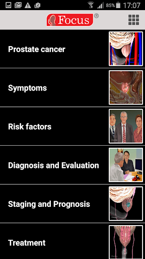 Prostate cancer Screen 2