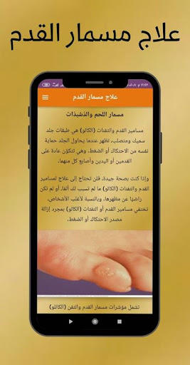 علاج مسمار القدم