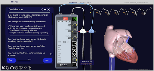 Medtronic VirtualEPG Screen 2