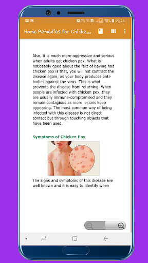 Home Remedies for Chicken Pox