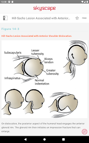 Screenshot 12 Handbook of Fractures android
