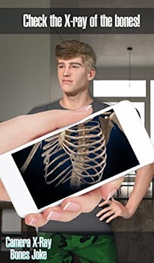 #2. BodyScanner Xray Scanning Game (Android) By: CoolCoder