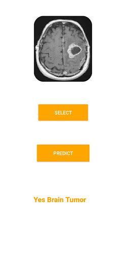 Neurosight Screen 2