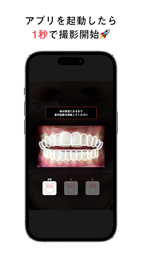 Android application Oh my teeth - Camera screenshort