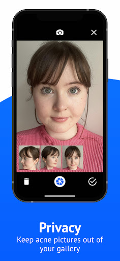 SkinTheory Skin + Acne Tracker screenshot