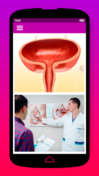 Gynecomastia a prostatitis alatt