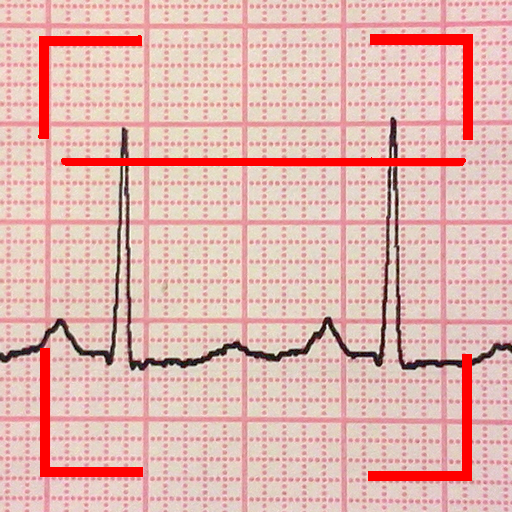 ECG Reader