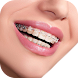 Real Braces Camera - Androidアプリ