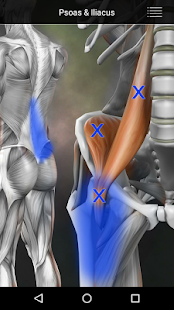 Muscle Trigger Point Anatomy Screenshot