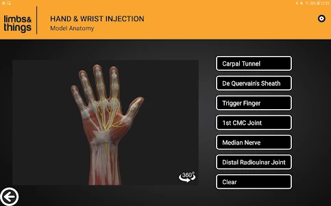 Hand & Wrist Injection