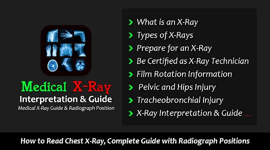 X-Ray Interpretation Guide