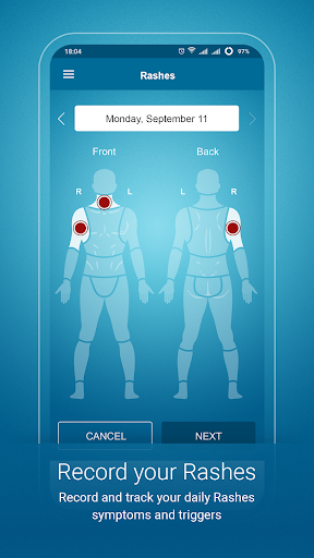 Psoriasis Monitor Screen 3