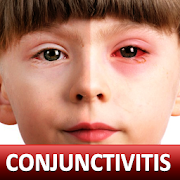 Help for Baby Conjunctivitis & Pinkeye in Children