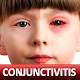 Help for Baby Conjunctivitis & Pinkeye in Children Скачать для Windows