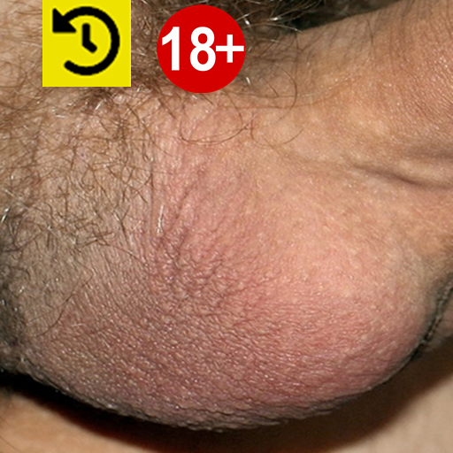 Scrotum Anatomy Tải xuống trên Windows