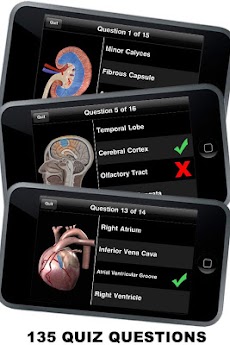 Anatomy 3D: Organsのおすすめ画像4