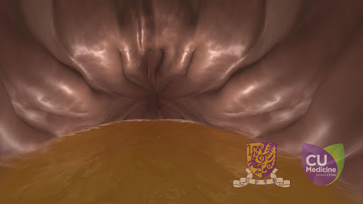 DigestVR (CUHK) Screen 2
