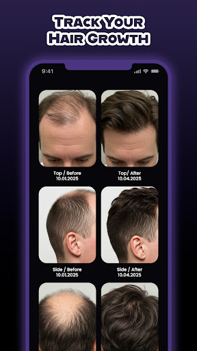 Screenshot of HairCode·Hair Loss Scanner AI
