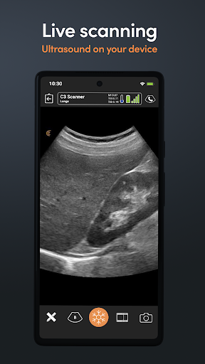 Clarius Ultrasound screenshot 6