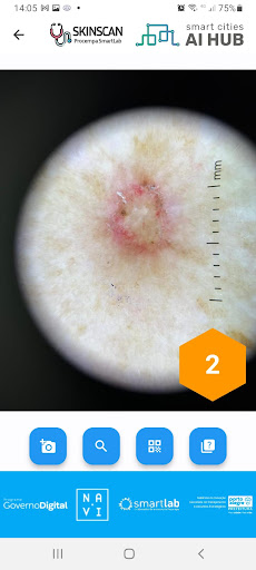 SkinScan Screen 3