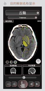 CT 护照 "头部" / 剖面解剖/ MRI