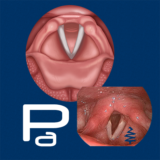 Paresis Paralysis Descarga en Windows