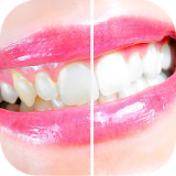 افضل وصفات لتبيض الاسنان 2015 icon