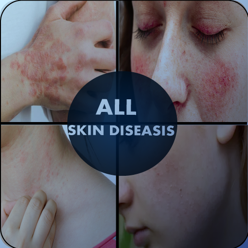 Skin Diseases & Treatment Download on Windows
