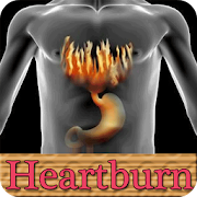 Home Remedy for Heartburn
