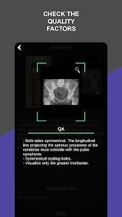 RX - Radiographic Positioning  Screenshots 6