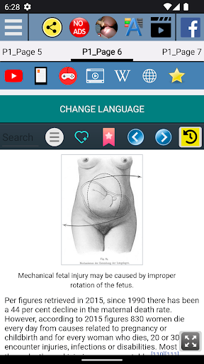 Childbirth Management