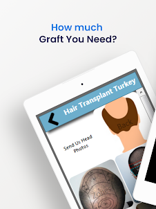 Hair Transplant Turkey / Graft