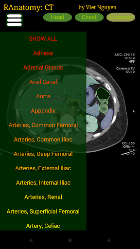 Radiology CT Anatomy 1.6 APK screenshots 2