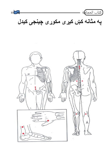 Hijama کتاب الھجامہ Screen 3