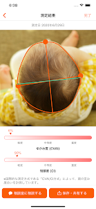 赤ちゃんの頭のかたち測定