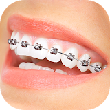 Braces App That Look Real icon