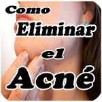 Cover Image of Baixar Como eliminar el acne  APK