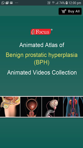 Android application Animated Atlas of BPH screenshort